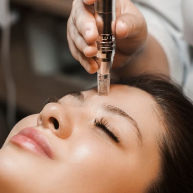 Microneedling Package at Skin & Toxx in Houston, TX